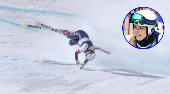 Lindsey Vonn sufre fractura compleja de tibia que requiere múltiples cirugías