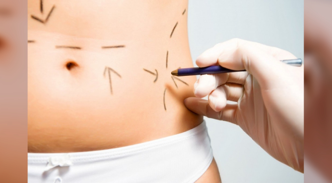 República Dominicana realiza un promedio de 65 mil cirugías estéticas cada año