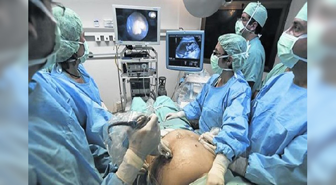 Médicos logran operar un feto en gestación para corregir la hidrocefalia en Colombia