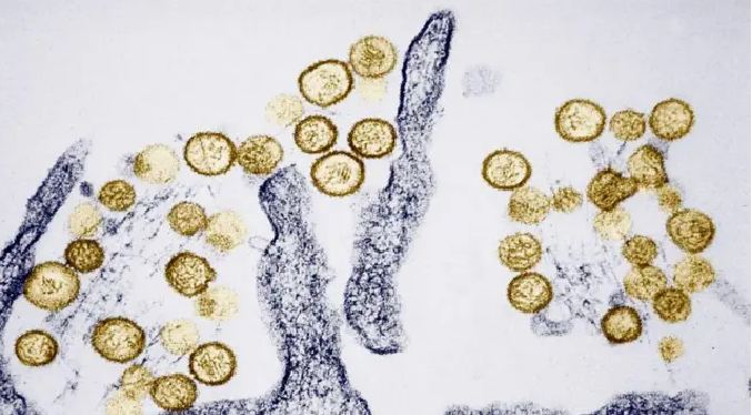 Confirman una muerte por hantavirus en Minas Gerais, Brasil