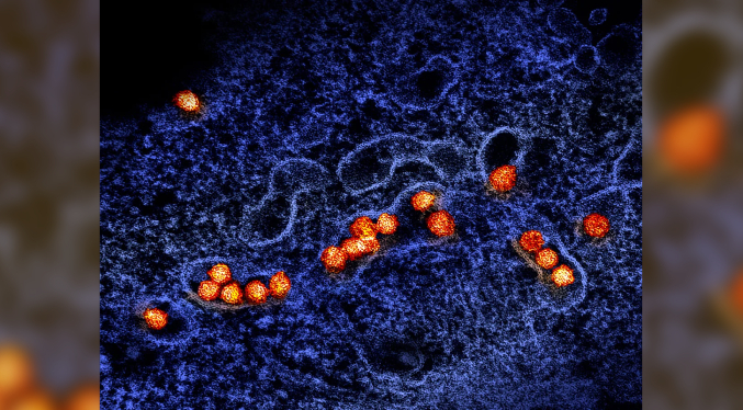 Macedonia del Norte reporta ocho casos con el virus del Nilo, todos hospitalizados