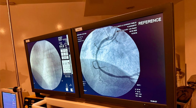 Plan Corazón Zuliano de la Gobernación atiende 10 nuevos casos de cateterismo y angioplastias