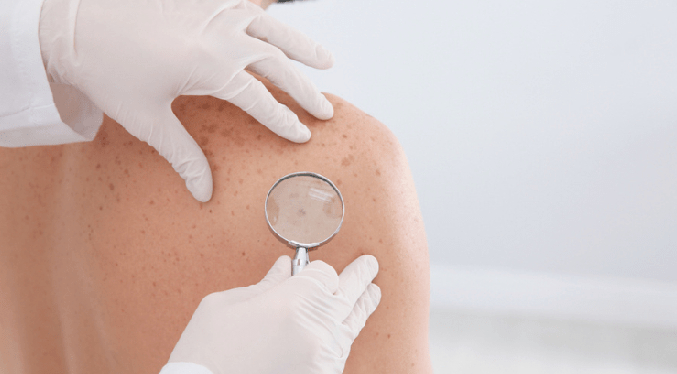 Sociedad Venezolana de Dermatología rechaza consejos de influencers sobre cuidados de la piel